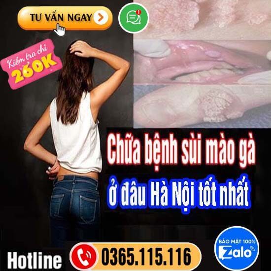 Top 9 địa chỉ chữa bệnh sùi mào gà ở đâu Hà Nội tốt nhất Top 9 địa chỉ chữa bệnh sùi mào gà ở đâu Hà Nội tốt nhất