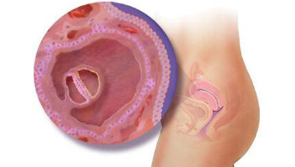 Quá trình phát triển của thai nhi trong bụng mẹ tuần 4