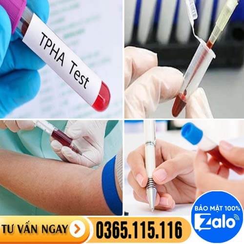 Năm 2025 chi phí xét nghiệm và chữa bệnh giang mai bao nhiêu tiền