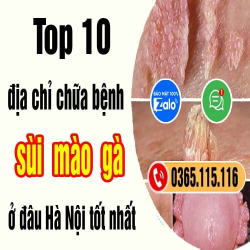 Top 10 địa chỉ chữa bệnh sùi mào gà ở đâu Hà Nội tốt nhất